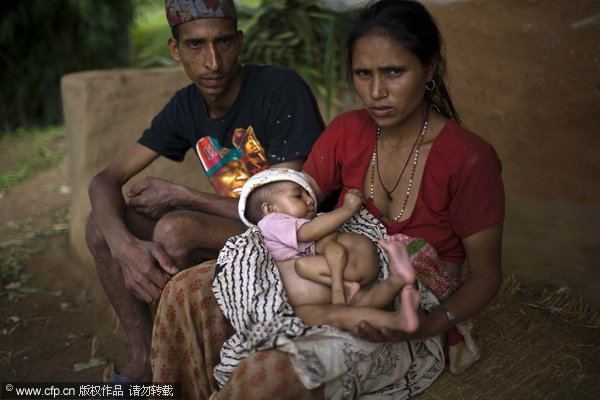 尼泊尔婴儿长四手四腿被视为神明转世