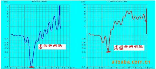 供应英国吉姆a1型鼻声反射仪