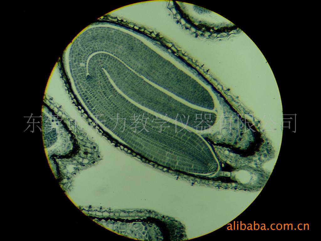 厂家直销 病理学教学切片肠癌 量大优惠 欢迎来电
