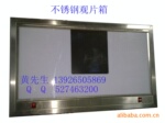 内嵌式不锈钢X光观片灯 看片箱