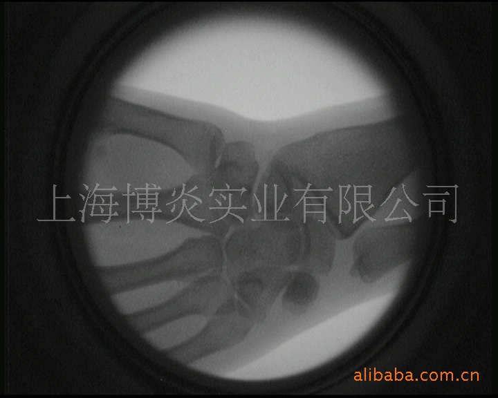 北京x光机,小型高清晰腰椎,脊椎透视仪