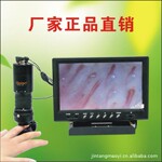 微循环检测仪 厂家正品直销 高清晰便携显微检查仪
