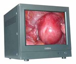 CRT监视器,内窥镜摄像系统用监视器, CH-15