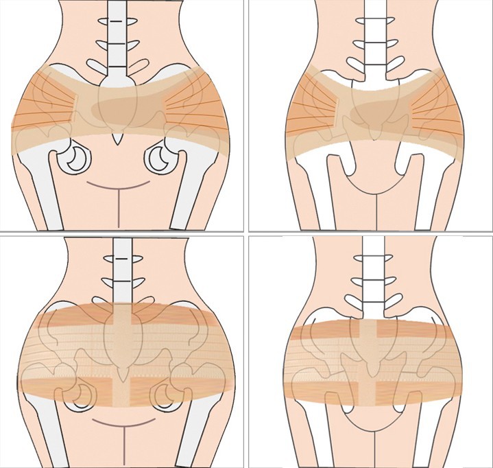供应骨盆矫正带 盆骨带 孕妇月子用品 产后身材走形专用