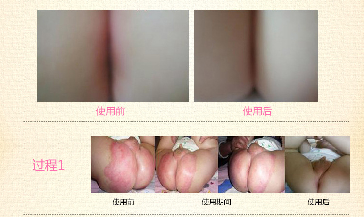 【芷御坊<em>宝宝</em>护臀膏 <em>尿布疹</em> 臀部干红 抑菌护理