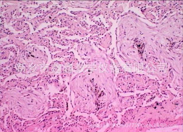 热销病理切片图片_10