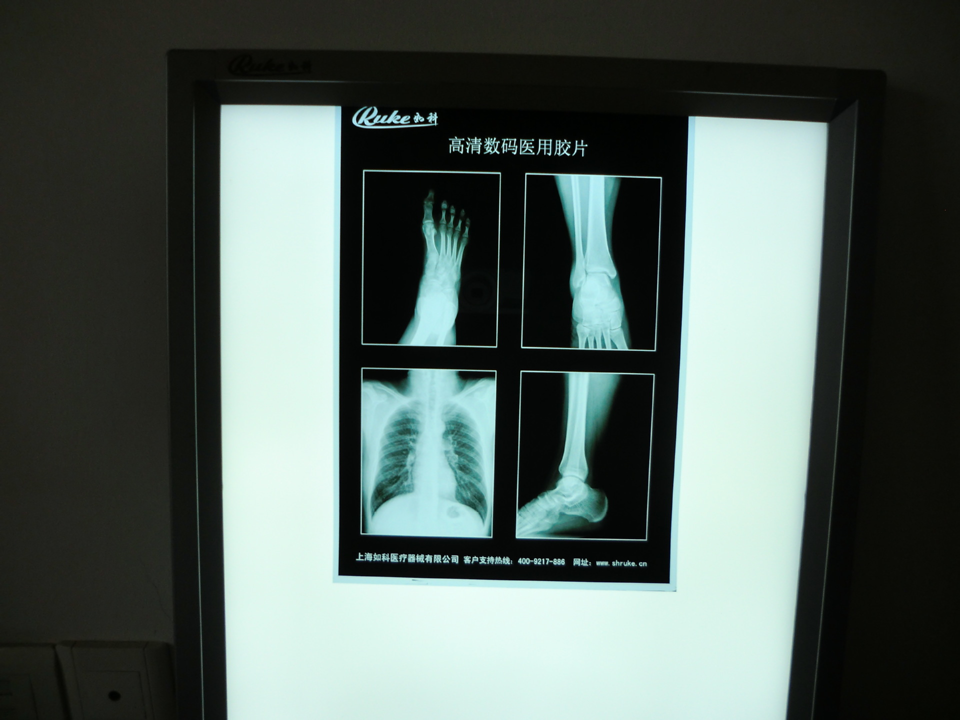 医用蓝色单面激光胶片 医院CT室照CT用 图片