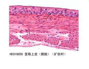 变移上皮(膀胱(扩张时)
