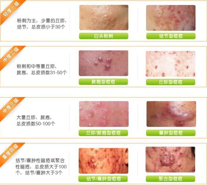 发采购美容仪器-厂家供应LED红蓝光祛痘仪|消