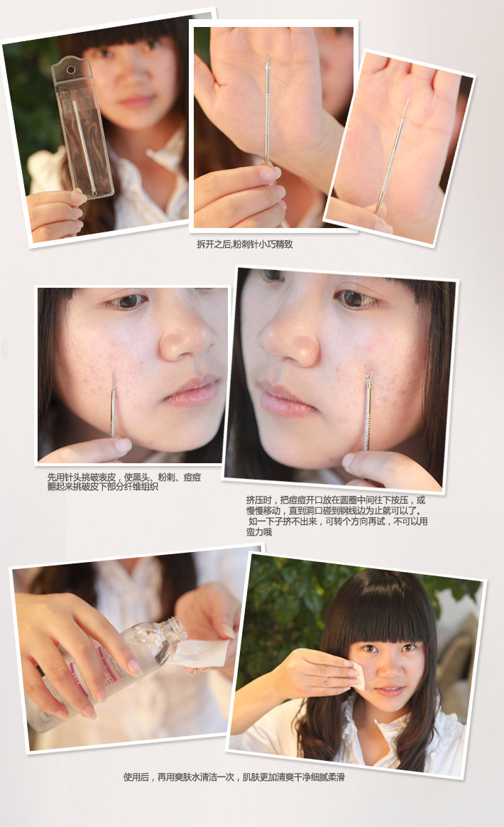 暗疮针使用图解,暗疮针怎么用,暗疮针去黑头使用 ...