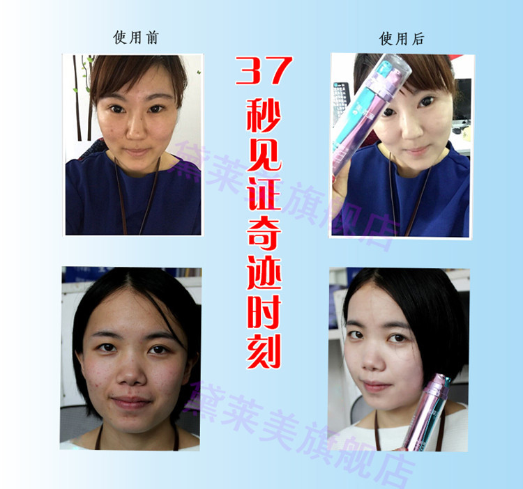 BB描述7