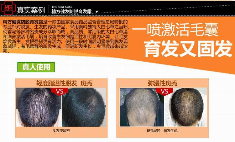 厂家直供 精方健发防脱育发露 防脱生发 国妆特字批号 正规产品