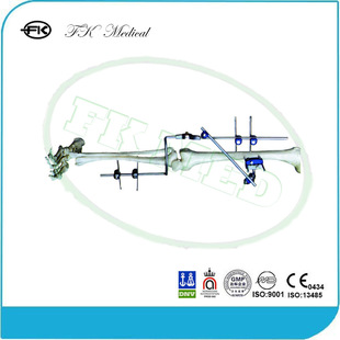 医用手术器械膝关节骨科外固定支架